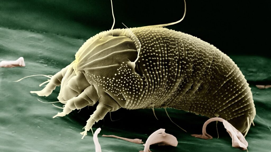 dust mite allergy is common and can trigger eczema and asthma
